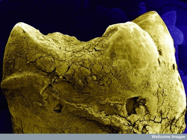 25種你不想在顯微鏡下看到的東西13