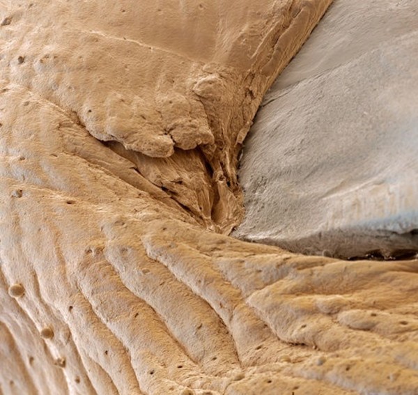 25種你不想在顯微鏡下看到的東西24