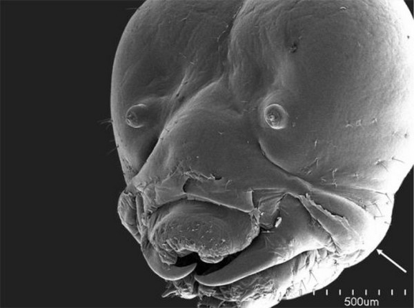 25種你不想在顯微鏡下看到的東西6