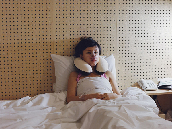 南韓人整形背後皮開肉綻的真相5