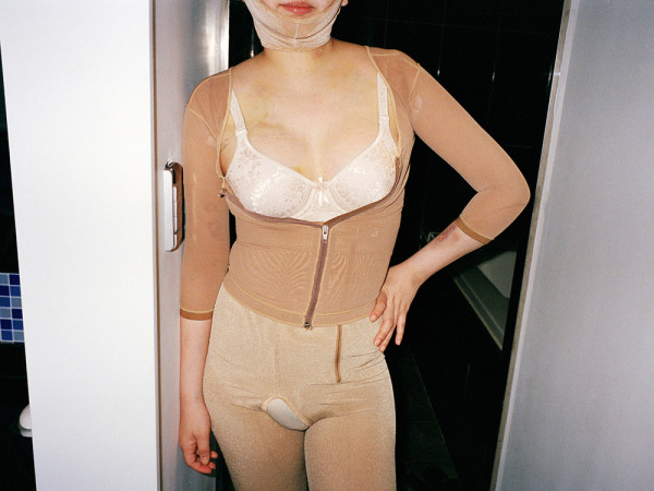 南韓人整形背後皮開肉綻的真相7