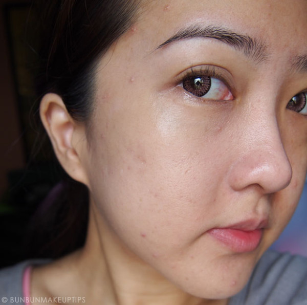 美妝部落客自po做臉慘痛代價3