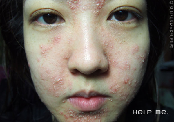 美妝部落客自po做臉慘痛代價6